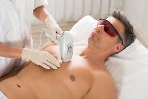 A man undergoing laser hair removal treatment.