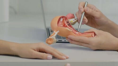 Polycystic Ovarian Syndrome and its Treatment