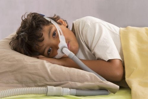 Obstructive Sleep Apnea in Children