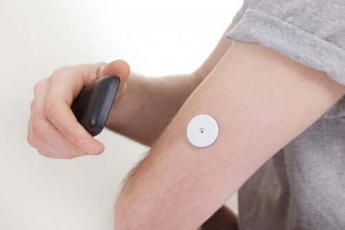 A continuous glucose monitor