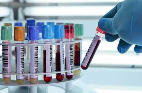 A lab technician looking at blood samples.
