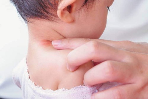 A baby with congenital torticollis.
