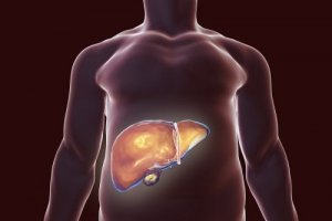 Gallbladder Diet Do's and Don'ts