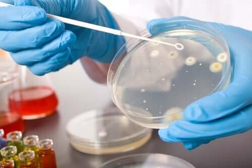 Bacteria culture.