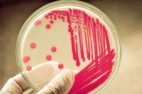 Bacteria in a petri dish.