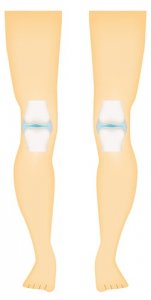The Types of Synovial Joints