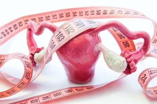 Adenomyosis: Symptoms and Treatment