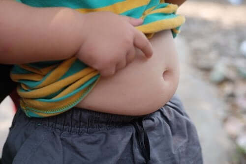 Childhood Obesity, a Big Problem