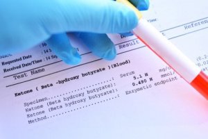 Causes and Treatment of Metabolic Acidosis