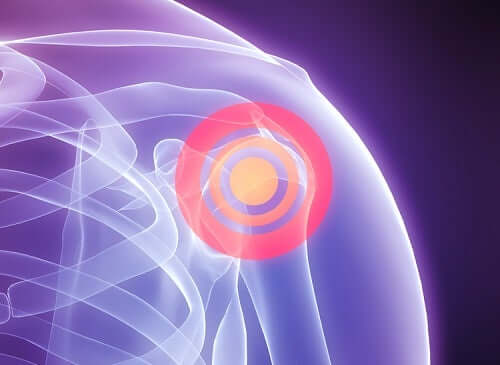 Shoulder pain.