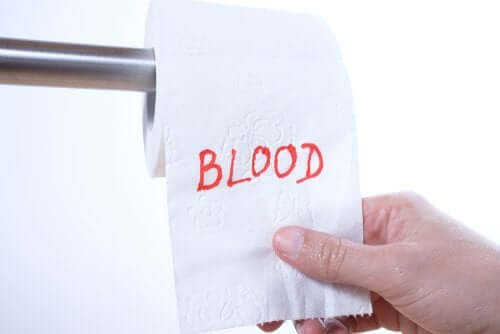 Rectal Bleeding: Why Does it Happen?