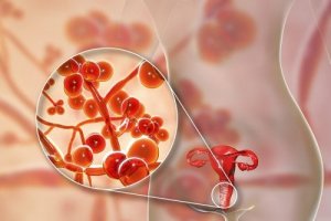 Mycoplasma Genitalium: Causes, Symptoms, and Treatment