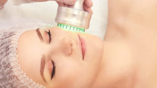 Radio-frequency skin treatment.