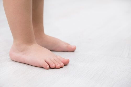 Flat Feet: Characteristics and Treatment