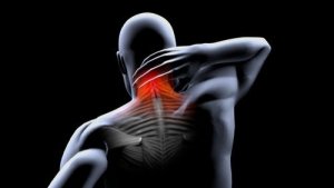 Muscle Contracture Prevention and Treatment