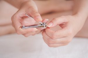 Onychocryptosis Prevention and Treatment
