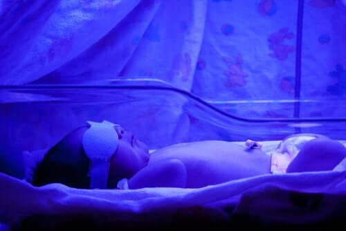 Neugeborenengelbsucht - Baby in einem speziellen Kasten