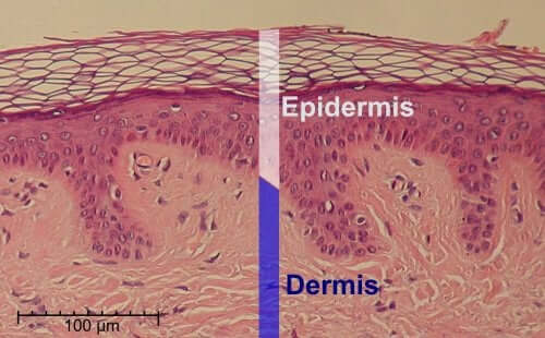 Skin epidermis and dermis.