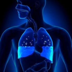 Pulmonary Edema: Symptoms and Causes