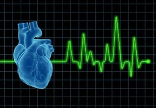 Tachycardia.