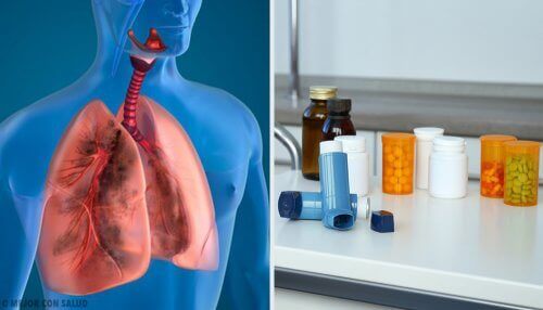 Treatment for COPD.