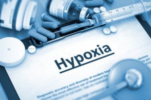 Cerebral Hypoxia: Types and Causes