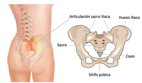 Diagram of a joint.