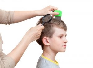 How to Get Rid of Nits Quickly