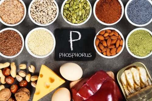 Hyperphosphatemia: A Phosphate Imbalance
