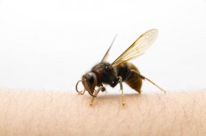 What to Do After an Asian Hornet Sting