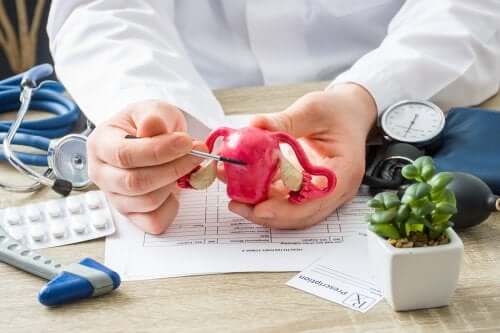 What You Need to Know about Uterine Polyps