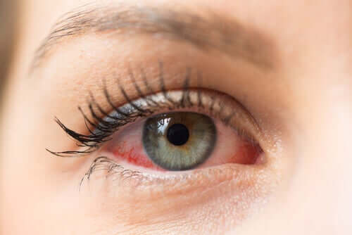 A woman's red eye