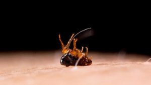 Tungiasis: Symptoms and Treatment