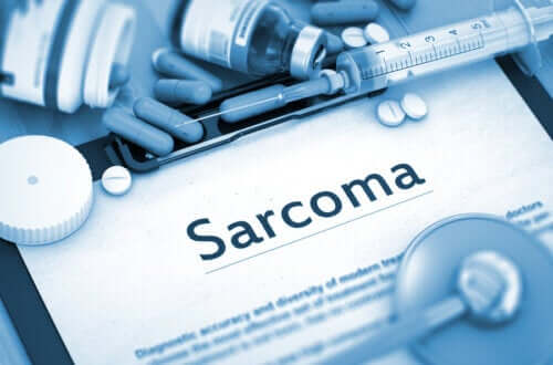 Sarcoma: Characteristics and Causes