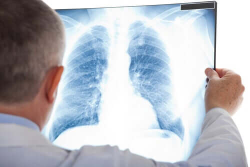 A person looking at an x-ray