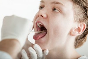 Burning Mouth - Why Does It Happen?