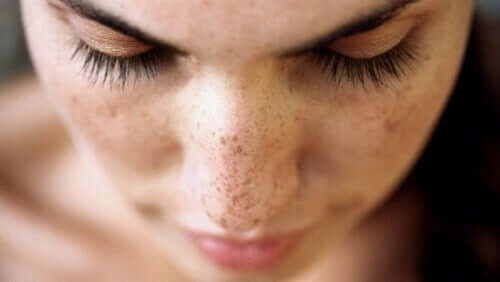 A woman with freckles.