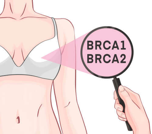 BRCA-1 and BRCA-2 Genes and Breast Cancer