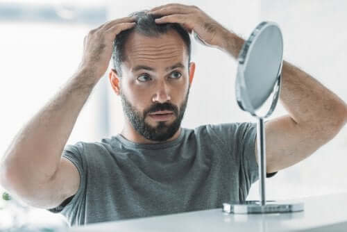Androgenic Alopecia: Symptoms, Causes and Treatment
