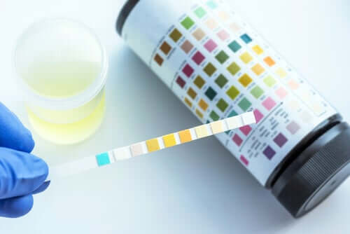 What Does a Urinalysis Detect?