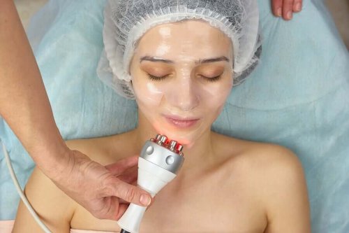 A woman getting facial RF.