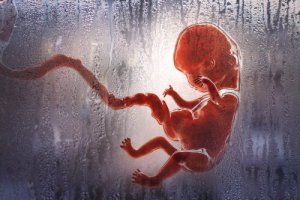Types of Abortions You Should Know