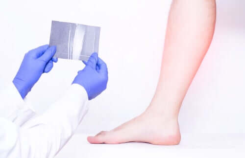 Man kan också drabbas av sammandragningar under graviditeten