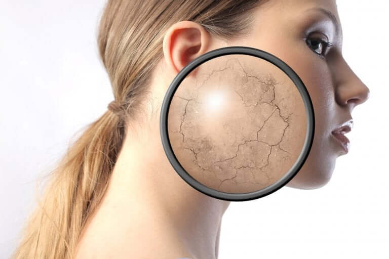 Woman with zoomed-in dry skin.
