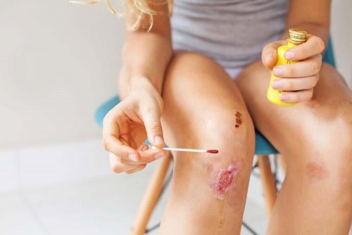 A girl with a wound.