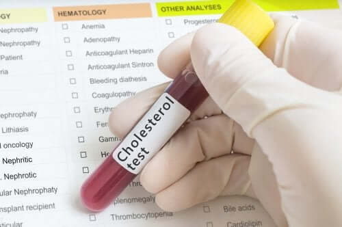 A blood cholesterol test.