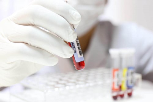 A doctor holding a blood test.