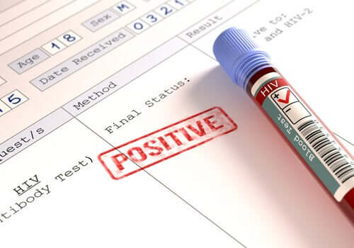 Are People with HIV more at Danger from Coronavirus?