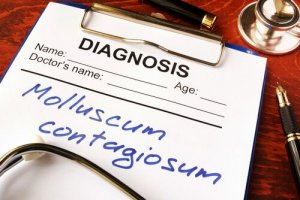 What is Molluscum Contagiosum?