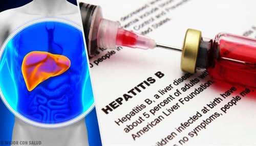 A representation of hepatitis B.
